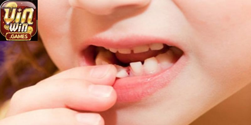 Ý nghĩa khi mơ thấy rụng răng